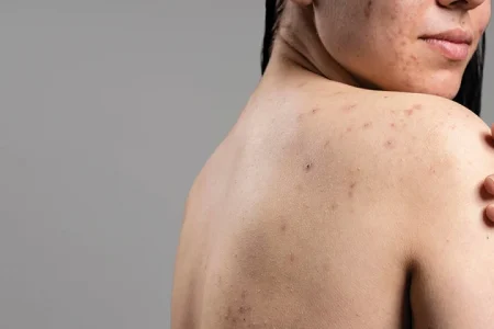 10 skin diseases images