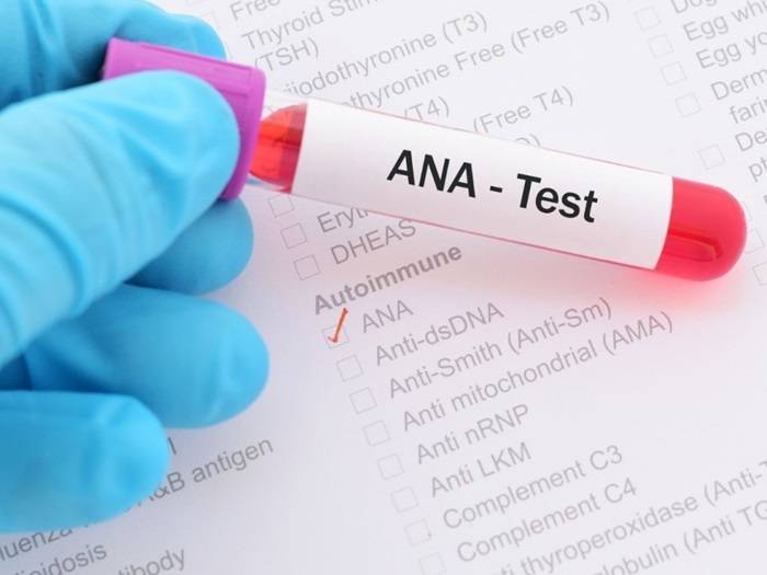 Understanding ANA Test