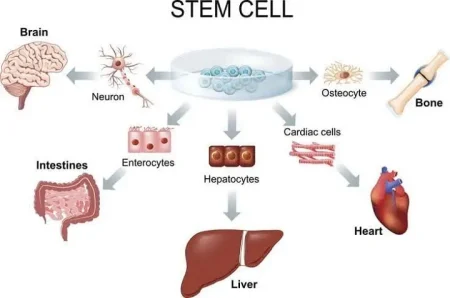 of Diseases Treated by Stem Cells
