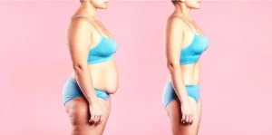 mommy makeover in turkey