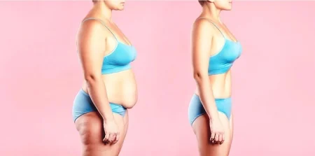 mommy makeover in turkey