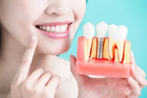 dental implant surgery preparation complete timeline guide