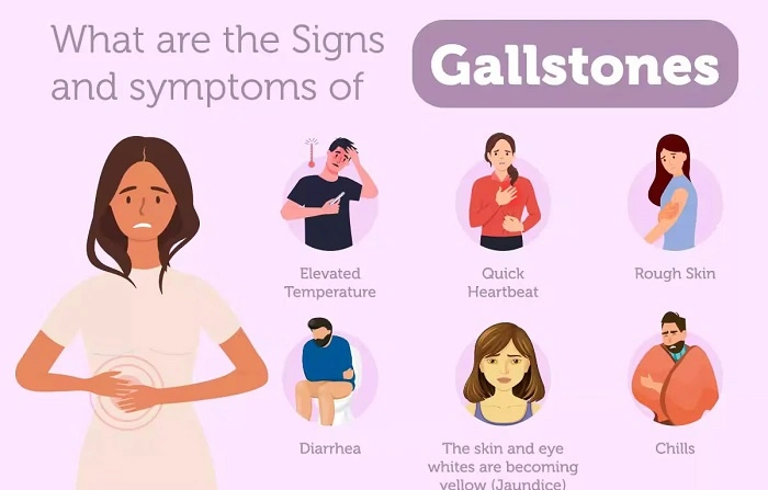 When to See a Doctor for Gallbladder Symptoms