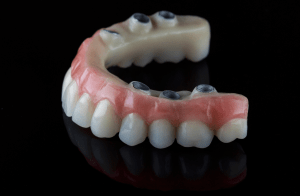 When Hybrid Full Arch Implants Become Your Best Option for Oral Health