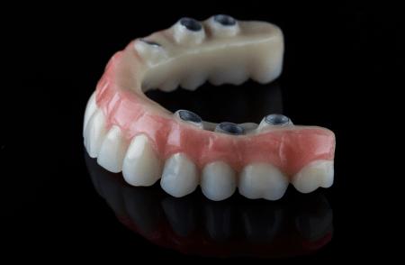 When Hybrid Full Arch Implants Become Your Best Option for Oral Health