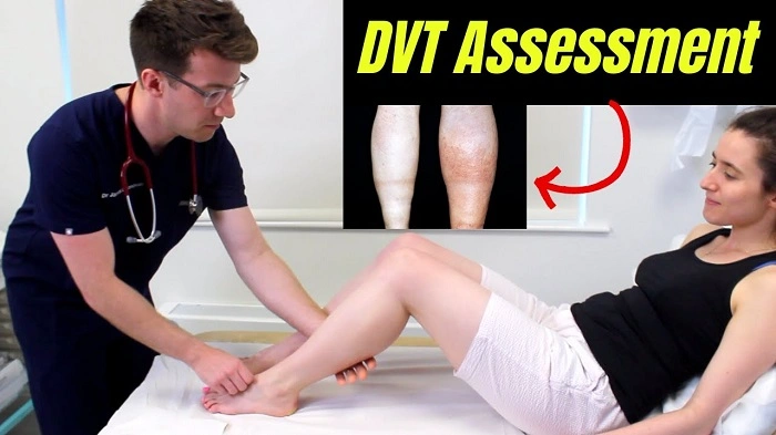 How Are Leg Blood Clots Diagnosed