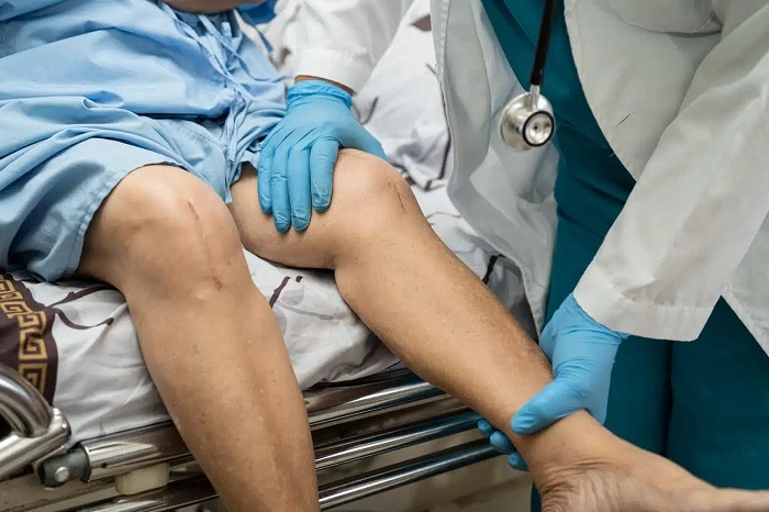 Advantages of Total Knee Replacement