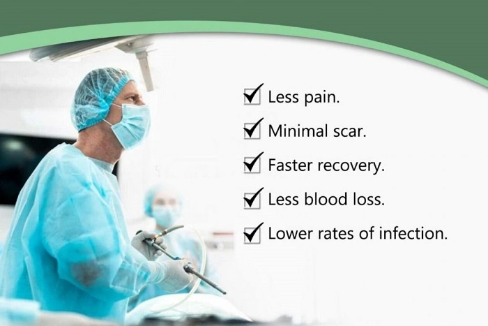 Benefits of Laparoscopy