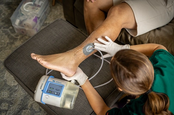 How to Care for a Wound VAC at Home