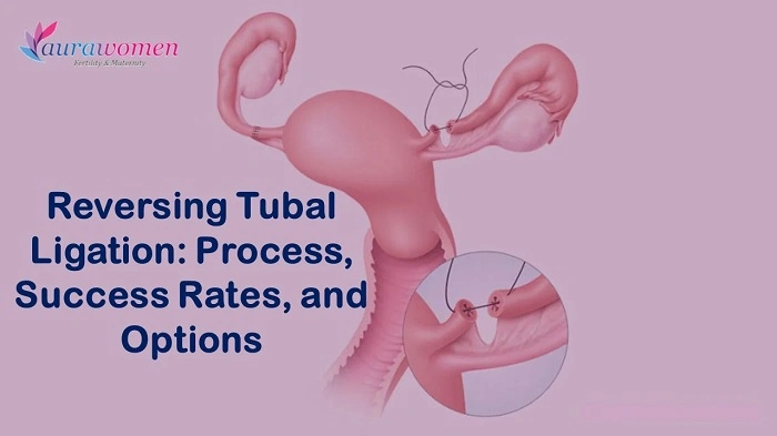 Recovery After Tubal Ligation Reversal