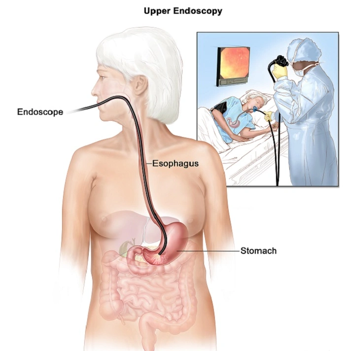 Tests for Digestion Problems