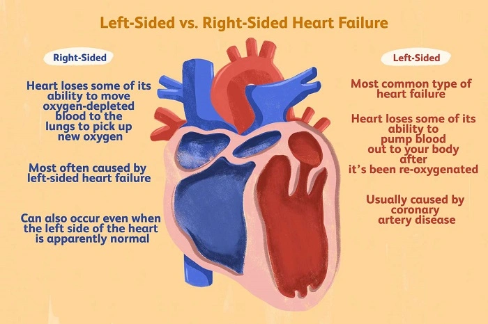 What Happens if the Left Side is Weakened
