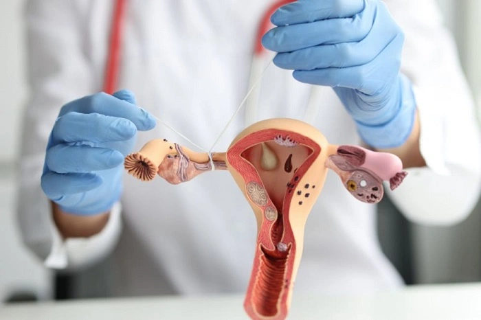 What Is Tubal Ligation Reversal