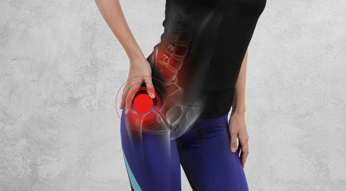 Why Hip Injuries Are Common in Sports