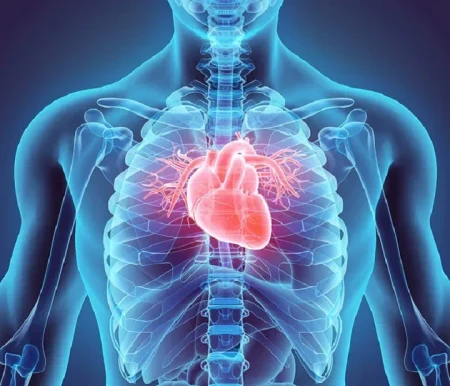cardiothoracic