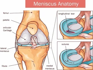 cartilage in knee