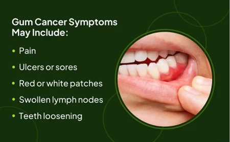 oral cancer symptoms